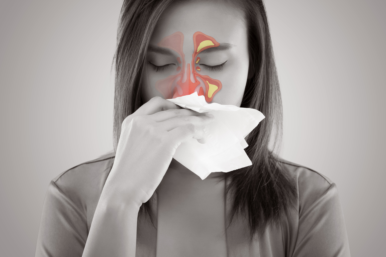 Symptoms of allergic rhinitis Clear, watery nasal discharge
