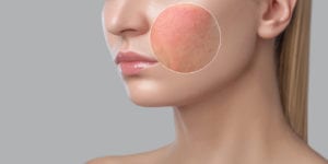 skin allergy treatment near me