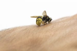 Bee stinging in human hand