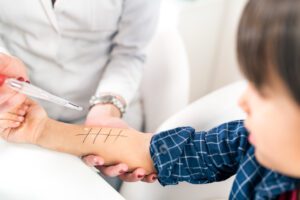 Allergist doing skin prick test on child