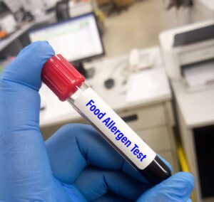Blood sample for food allergen test