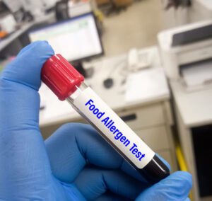 Blood sample for food allergen test